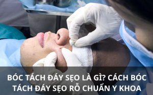 Bóc tách đáy sẹo