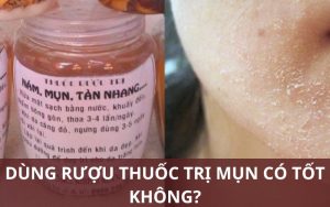 Dùng rượu thuốc trị mụn có tốt không