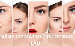 Nâng cơ mặt giữ được bao lâu?