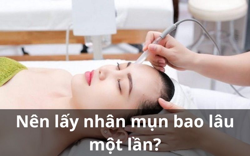 Nên lấy nhân mụn bao lâu một lần