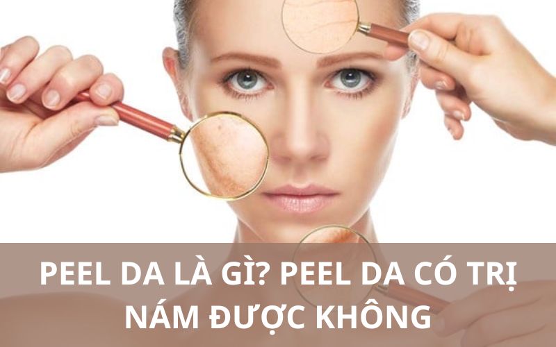 sản phẩm Peel Da Trị Nám