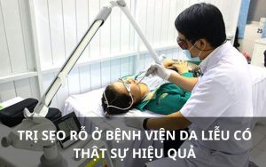 Trị sẹo rỗ ở bệnh viện da liễu