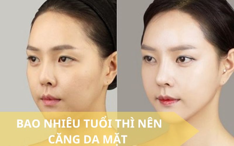 Bao nhiêu tuổi thì nên căng da mặt