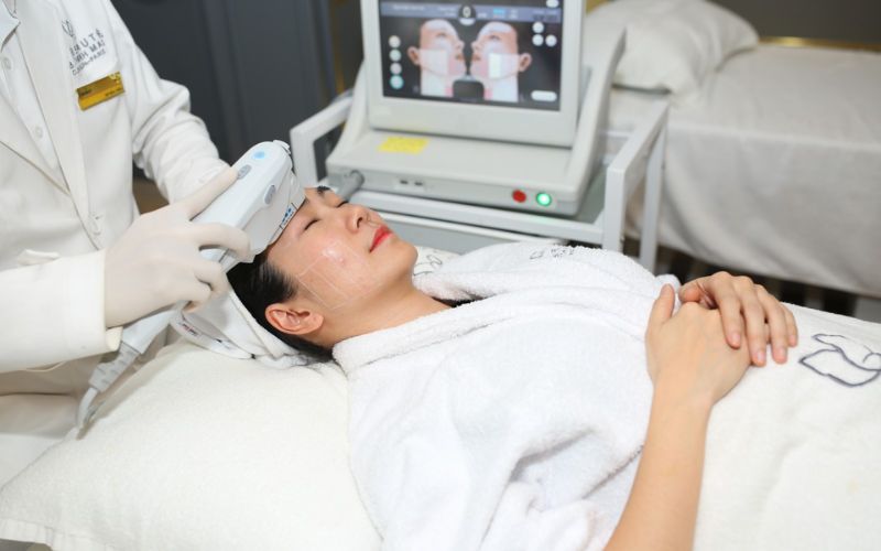 Căng da mặt không phẫu thuật bằng công nghệ Ultherapy