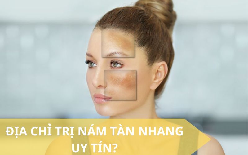 Địa chỉ trị nám tàn nhang uy tín