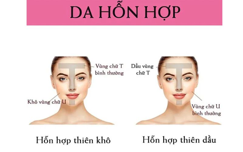 Cách nhận biết da hỗn hợp