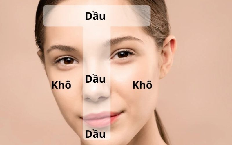 Khái niệm Da hỗn hợp là gì?