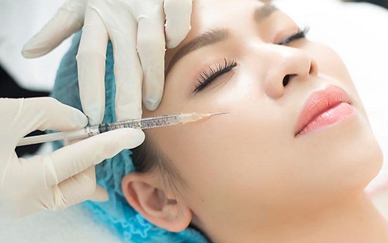 Tiêm filler điều trị sẹo rỗ