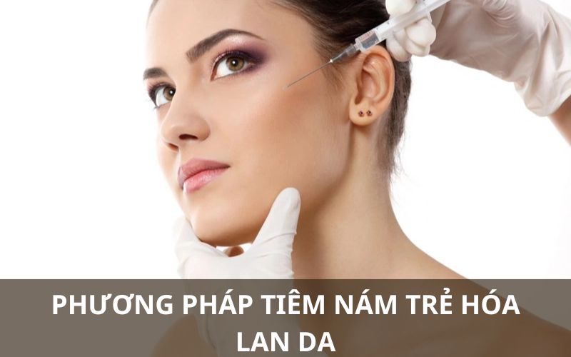 Phương pháp tiêm nám