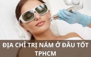 Trị nám ở đâu tốt TPHCM