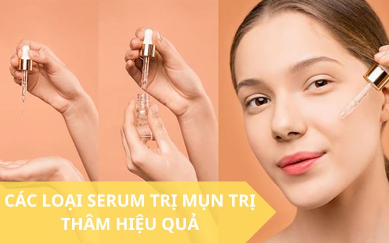 Top các loại serum trị mụn trị thâm tốt hiện nay