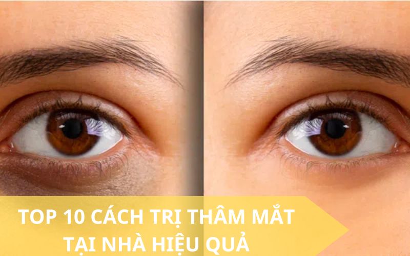 Cách trị thâm mắt tại nhà hiệu quả